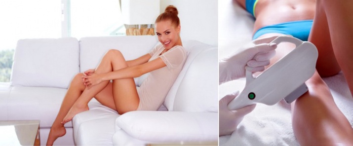 Elos-эпилятор: модели для домашнего использования; Iluminage Me Touch 300К; и; Iluminage Precise Touch, отзывы () Elos-эпилятор: модели для домашнего использования; Iluminage Me Touch 300К; и; Iluminage Precise Touch, отзывы