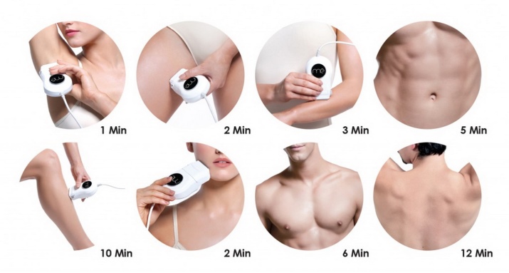 Elos-эпилятор: модели для домашнего использования; Iluminage Me Touch 300К; и; Iluminage Precise Touch, отзывы () Elos-эпилятор: модели для домашнего использования; Iluminage Me Touch 300К; и; Iluminage Precise Touch, отзывы
